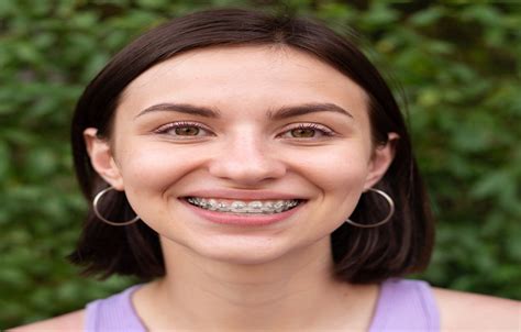 education needed to be an orthodontist: the journey to mastering the art of aligning smiles